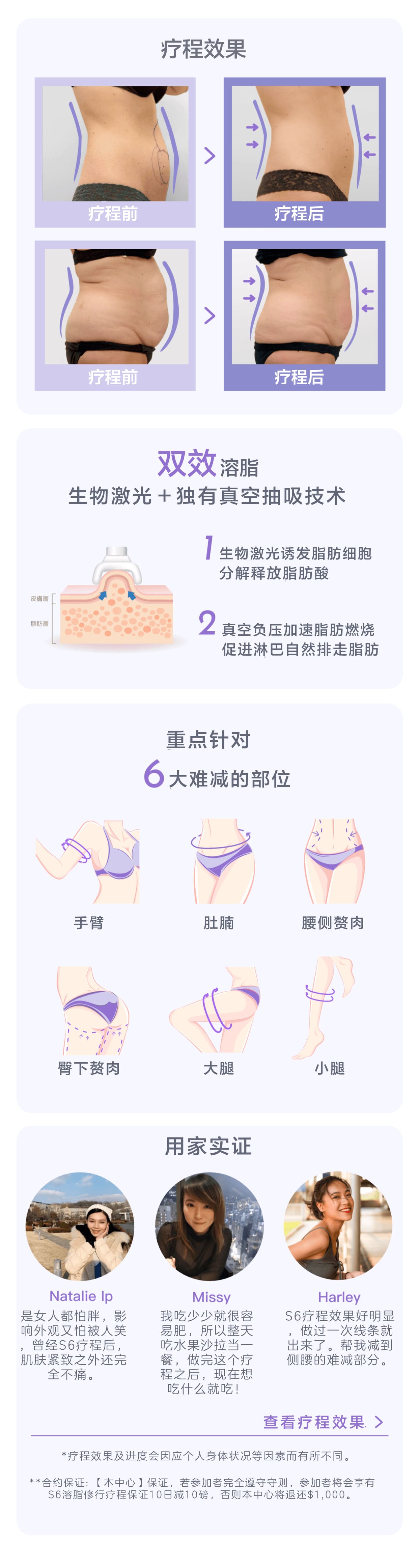 [免费体验] S6 溶脂修形疗程 | New Beauty